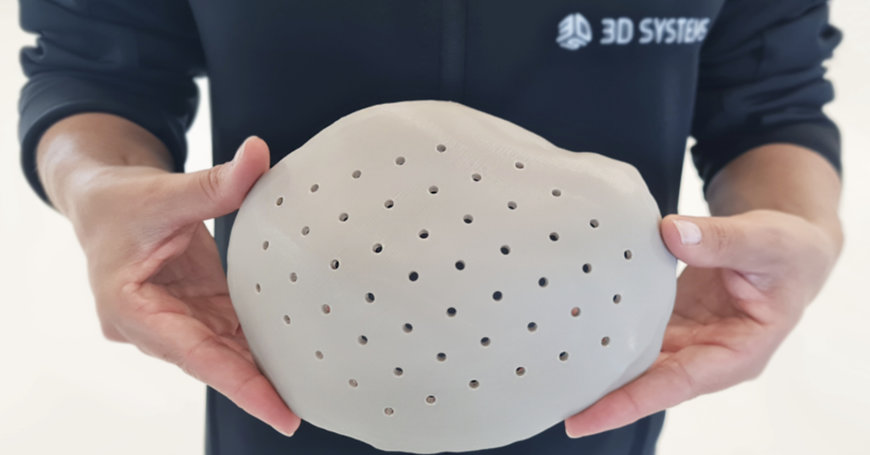 3D Systems annuncia di aver ricevuto il nulla osta della FDA per i primi impianti cranici in PEEK stampati in 3D al mondo
